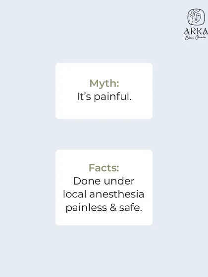 Myth: A hair transplant is a painful procedure. Fact: We perform the entire procedure under local anesthesia, which makes it painless and safe. Most patients report only minor discomfort during recovery.