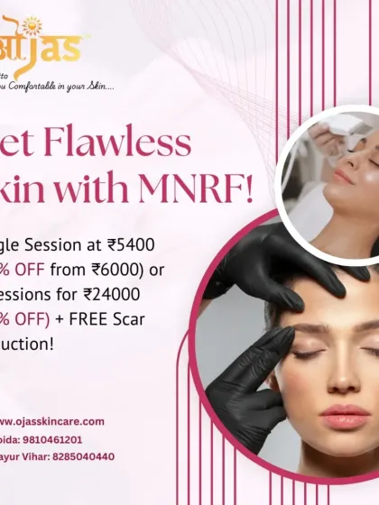 Get flawless skin with our MNRF treatment. It's a powerful solution for scars and texture issues. We are offering special discounts on single sessions and packages, including a free scar reduction treatment.