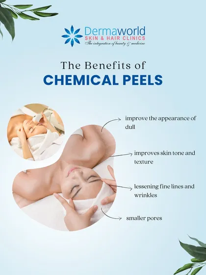 This graphic illustrates the primary benefits of a chemical peel. The procedure improves skin tone and texture by promoting cell turnover, which helps lessen fine lines, reduce the appearance of pores, and give dull skin a refreshed look.