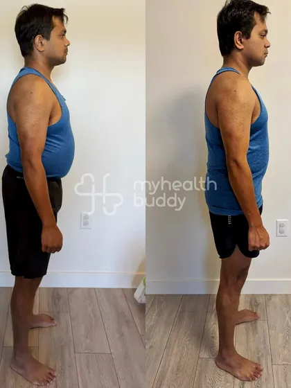 This vegetarian client lost 5 kgs and significant body fat in 3 months, even with a lot of work travel. He stuck to his meal plan and used hotel gyms, showing that determination overcomes any obstacle.