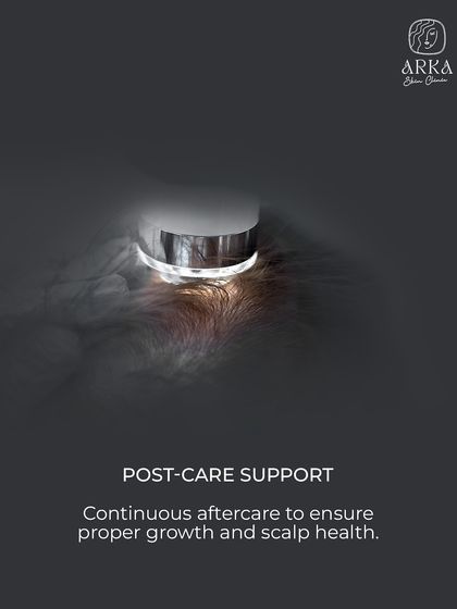 Our commitment to you doesn't end after the procedure. We provide continuous post-care support to ensure proper growth, monitor your scalp health, and maintain your long-term results.