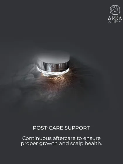 My support doesn't end after the treatment. Continuous aftercare is crucial to ensure proper hair growth and long-term scalp health.