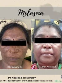 Cosmetic & Anti-Aging Treatments