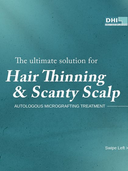 **The Ultimate Solution for Hair Thinning:** We specialize in Autologous Micrografting Treatment, an advanced solution for hair thinning and a scanty scalp. This approach uses your body's own regenerative capabilities to restore hair density naturally.