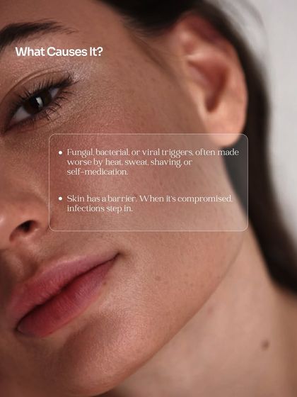 Your skin is your body's first line of defense. When its barrier is compromised by triggers like bacteria, heat, or sweat, infections can step in, leading to flare-ups and discomfort.