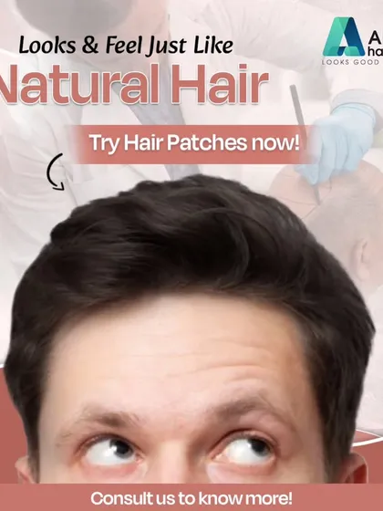 This image emphasizes that our hair patches look and feel just like natural hair. They are a seamless, custom solution to regain your confidence.