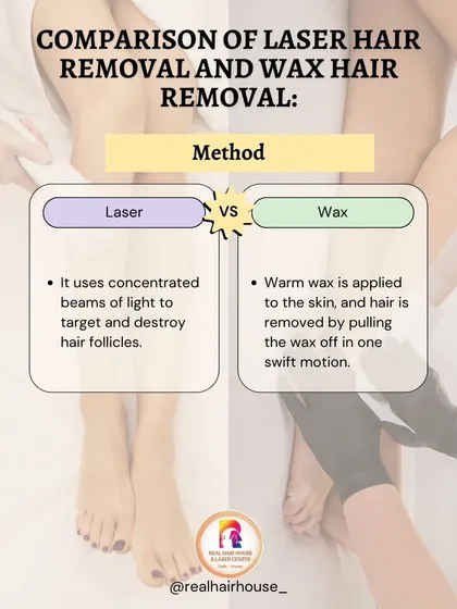 This infographic compares the method of laser hair removal, which uses concentrated light to destroy follicles, against waxing, which involves pulling hair out from the surface.