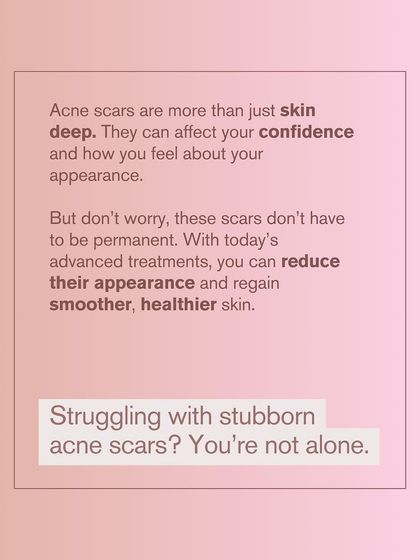 Acne scars are more than just skin deep; they can affect your confidence. But they don't have to be permanent. Advanced treatments can reduce their appearance and help you regain smoother skin.