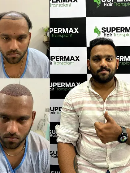 A collage showing a happy client after his transplant. We deliver results that make you smile.