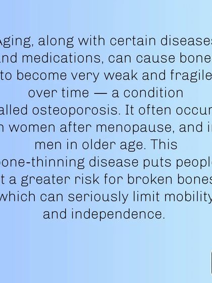 Osteoporosis, a condition of brittle bones, is a serious risk as we age. It can be mitigated with proper exercise and nutrition.