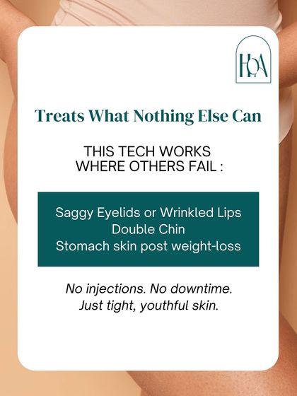 This technology works where others fail. For concerns like saggy eyelids, wrinkled lips, or a double chin, Exilis offers a powerful solution with no injections and no downtime, just tight, youthful skin.