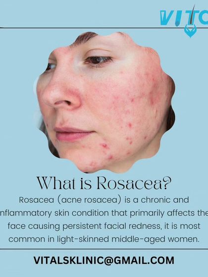 Vitals Klinic - Medical Dermatology Managing Chronic Skin Conditions photo 3