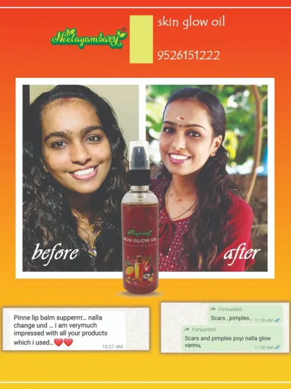 This is the result that makes all my hard work worth it. You can see how our Ayurvedic Skin Glow Oil helped reduce scars and pimples, bringing out a natural, healthy glow. Seeing this kind of happiness in my customers is my biggest reward.