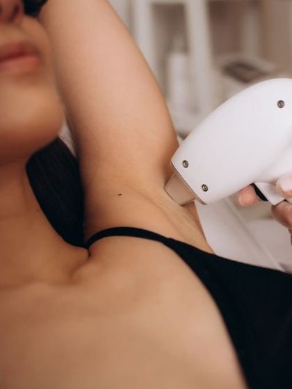 Underarm laser hair removal is one of the most requested services at my clinic. The treatment is very quick and effective, and after a few sessions, my patients enjoy the freedom of not having to worry about underarm hair or the dark shadows that shaving can leave behind.