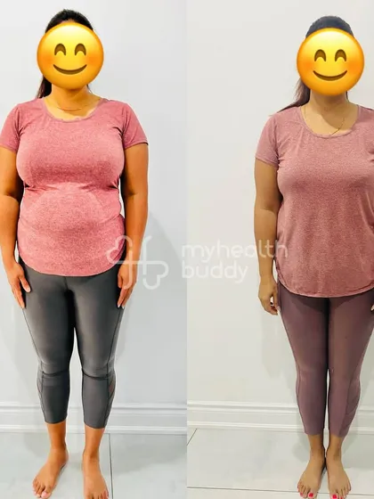 A working mom of two who lost 8 kgs in 6 months. Even with a busy routine and festivals, she stayed consistent, proving that you can balance life and still achieve your fitness goals.