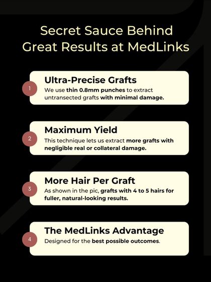 What is our secret sauce? It's a combination of using ultra-precise 0.8mm punches for minimal damage, maximizing the yield of healthy grafts, ensuring more hairs per graft, and the overall MedLinks advantage of a technique designed for the best possible outcomes.