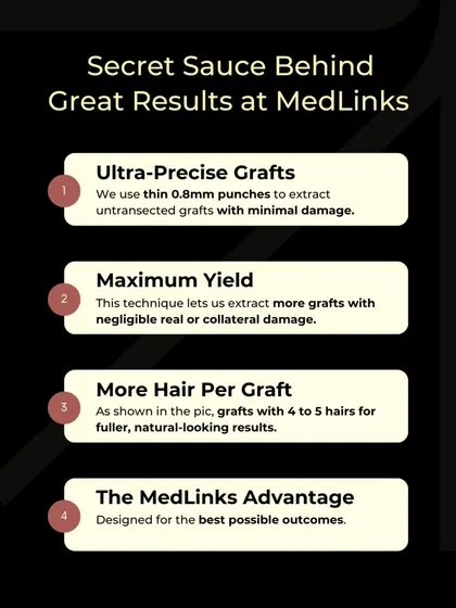 What is our secret sauce? It's a combination of using ultra-precise 0.8mm punches for minimal damage, maximizing the yield of healthy grafts, ensuring more hairs per graft, and the overall MedLinks advantage of a technique designed for the best possible outcomes.