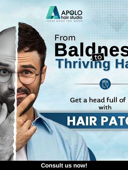 Go from baldness to thriving hair with our hair patch solution. This graphic illustrates the dramatic change possible, giving you a full head of hair and a bold new look.