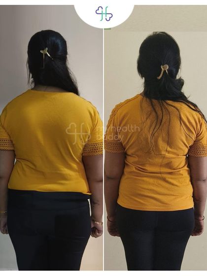 The back view of Yashika's transformation shows a clear reduction in body fat. Her energy levels and lactation also improved with the healthy diet plan.