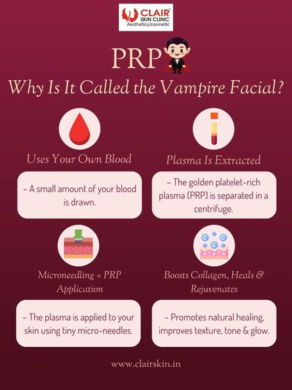 Why is it called the Vampire Facial? This infographic explains the PRP process step by step: drawing blood, separating the golden plasma, and applying it via microneedling to boost collagen and promote natural healing for a radiant glow.