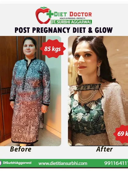 This client's transformation showcases the "Post Pregnancy Diet & Glow" that is possible with a sustainable, nutrient-focused plan. We focused on restoring energy and achieving fat loss without compromising her health, resulting in a 16 kg weight reduction from 85 kgs to 69 kgs.