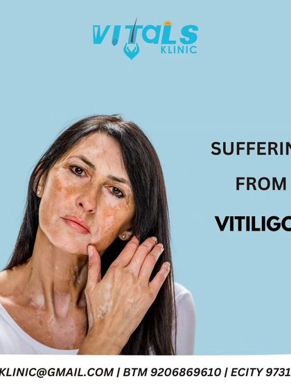 Vitals Klinic - Medical Dermatology Vitiligo & Pigment Restoration photo 9