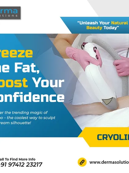 Here you can see the Cryolipolysis applicator in use. This non-surgical procedure, often called fat freezing, precisely cools and eliminates stubborn fat cells without harming the surrounding tissue. It is a safe and effective way to target specific areas that don't respond to diet and exercise.