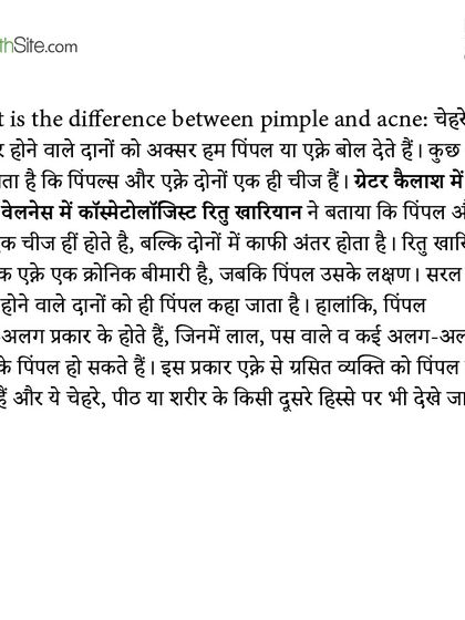 An excerpt from my article in The Health Site, where I clarify the difference between a pimple and acne. Acne is the disease, and a pimple is a symptom.
