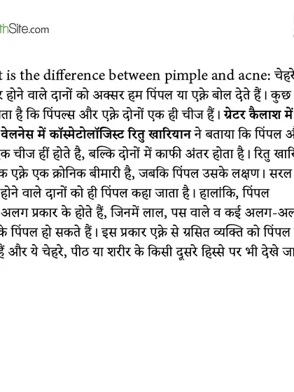 An excerpt from my article in The Health Site, where I clarify the difference between a pimple and acne. Acne is the disease, and a pimple is a symptom.