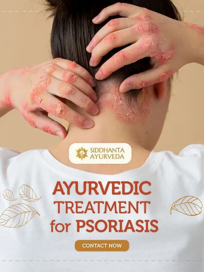 Psoriasis can affect self-confidence and mental well-being. My Ayurvedic treatment protocol is designed to address these aspects by providing effective, long-term relief from the physical symptoms.