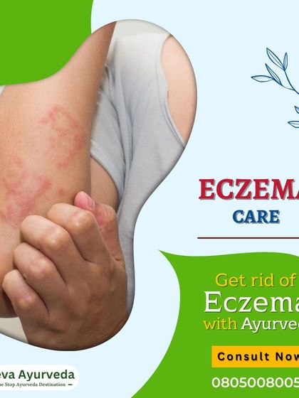 We help you get rid of Eczema with Ayurveda by addressing the vitiated pitta dosha that triggers it. Our experts can help manage symptoms like dry skin, red patches, and swelling through a holistic and natural approach.