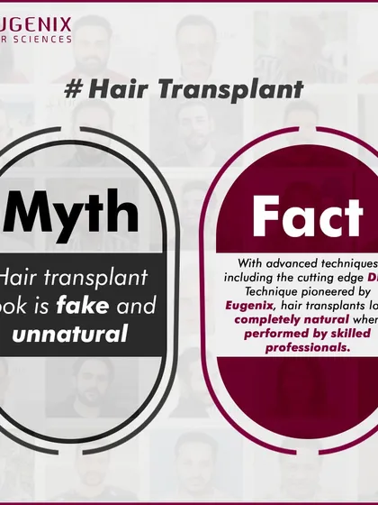We tackle the biggest myths head-on: hair transplants are painful, only for celebrities, look fake, are dangerous, or are better done abroad.