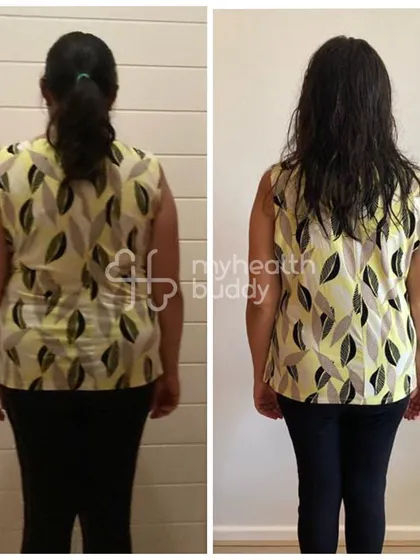 This client lost 7 kgs in 3 months, even with a thyroid condition and the stress of moving to a new country. Her back view shows a leaner, stronger frame.
