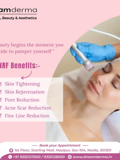 A client undergoing an MNRF treatment. The benefits include skin tightening, rejuvenation, pore reduction, and a visible reduction in acne scars and fine lines.