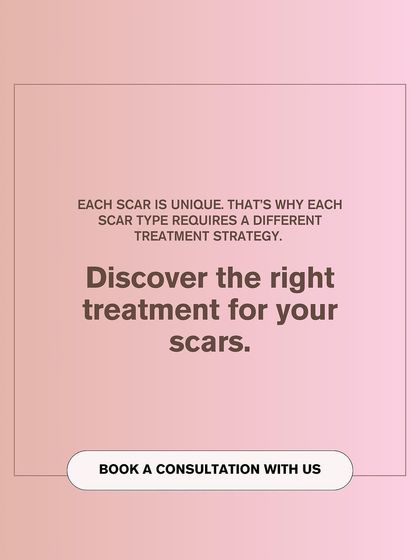 Each scar is unique, and so is the treatment it requires. A consultation is essential to discover the right strategy for your specific type of acne scars.