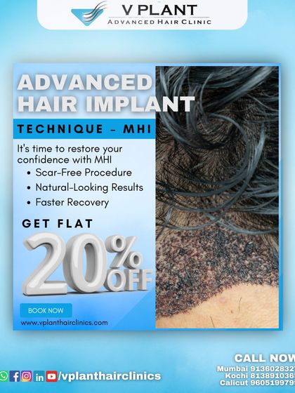 Take advantage of our special offer. This graphic announces a flat 20% discount on our advanced MHI hair implant technique, which promises a scar-free procedure, natural-looking results, and faster recovery.