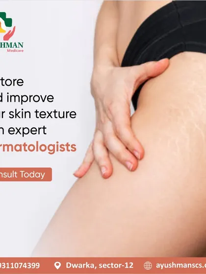Smooth, even skin texture is achievable with the help of our expert dermatologists. We offer treatments designed to restore and improve skin affected by concerns like stretch marks, helping you feel more confident in your skin.