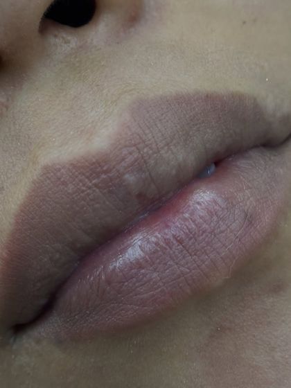 This is the 'before' for a lip blush client. The lips have a naturally pale tone, which is the perfect canvas for adding a beautiful, lasting tint.