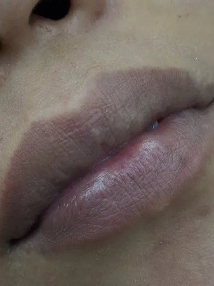 This is the 'before' for a lip blush client. The lips have a naturally pale tone, which is the perfect canvas for adding a beautiful, lasting tint.