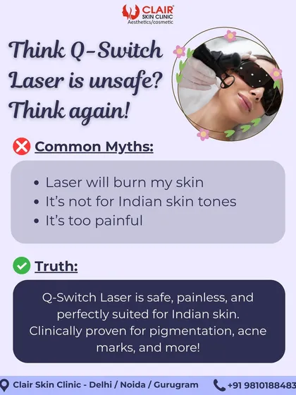 We bust common myths about the Q-Switch laser. This technology is safe, painless, and perfectly suited for Indian skin tones to treat pigmentation and acne marks effectively.