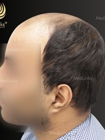 Another 'before' angle from the side.