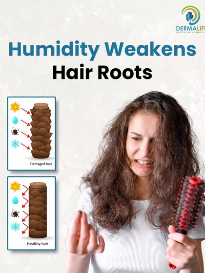 High humidity during monsoon weakens hair roots, leading to increased hair fall.