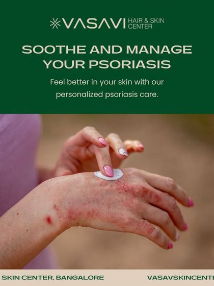 Sree Vasavi - Dermatology Consultation Common Skin Concerns & Treatments photo 20