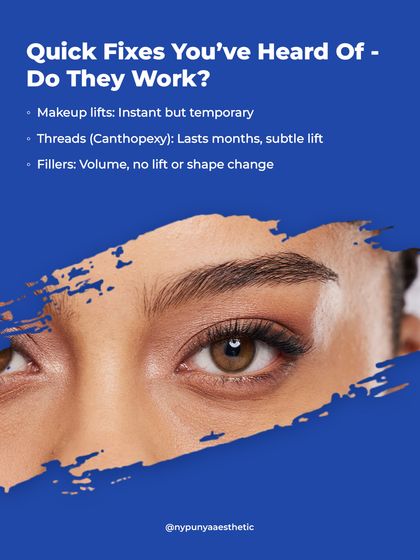 There are quick fixes you've heard of, but do they work? Makeup is temporary. Threads can provide a subtle lift for months. Fillers add volume but don't lift or change the eye shape.