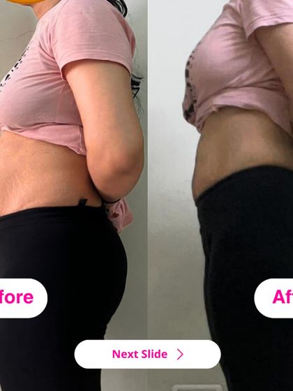 A side view of this mama's 7kg weight loss, showing a significant reduction in belly fat and improved body tone.