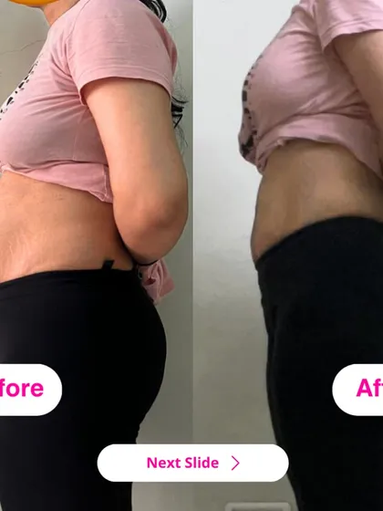 A side view of the same powerful 7kg weight loss transformation. Notice the reduction in belly fat and improved posture, which comes from strengthening the core and eating for health.