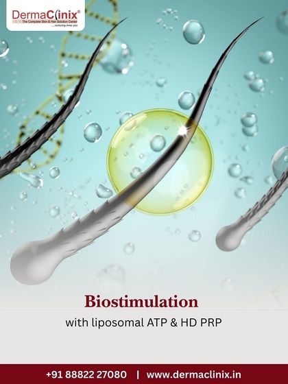Biostimulation with liposomal ATP and HD PRP is an advanced technique we use to energize and nourish hair follicles at a cellular level for enhanced growth.
