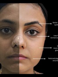 Medical-Grade Facials & Peels