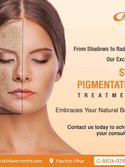This image represents the goal of my skin pigmentation treatments. I work to reduce shadows and reveal your natural radiance, helping you feel confident in your own skin.