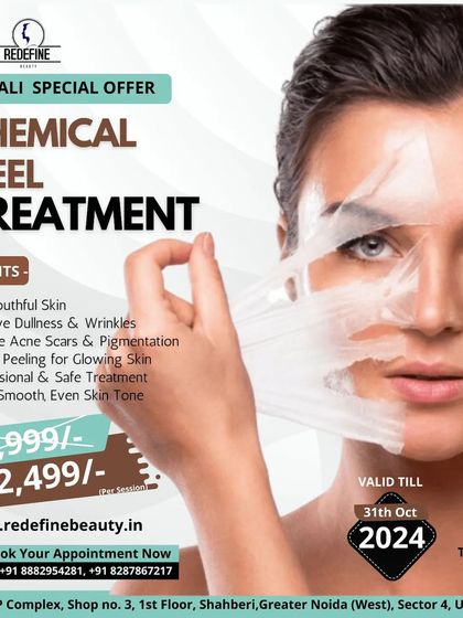 Chemical peels are a fantastic way to get smoother, more even-toned skin. This Diwali special offer highlights the benefits, including reducing acne scars, removing dullness, and promoting a youthful glow.
